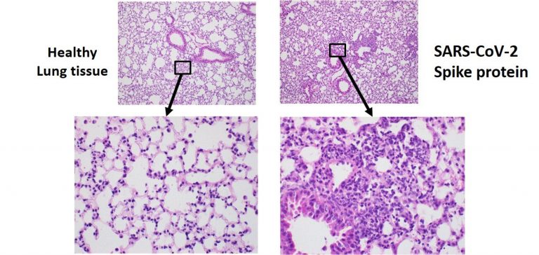 Coronavirus Spike Protein Alone May Cause Lung Damage