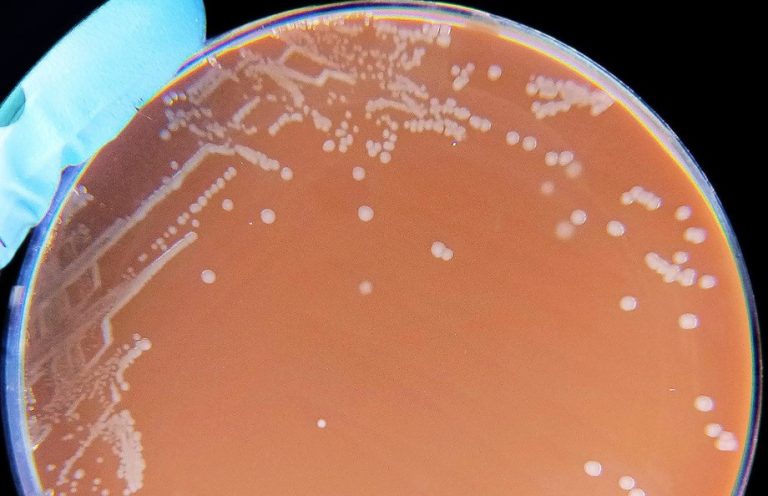 Does COVID-19 Have a Hidden Helper That Sometimes Makes it Deadly?