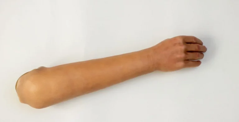 Italian Man Attempts to Fool Vaccine Mandate by Wearing Fake Arm