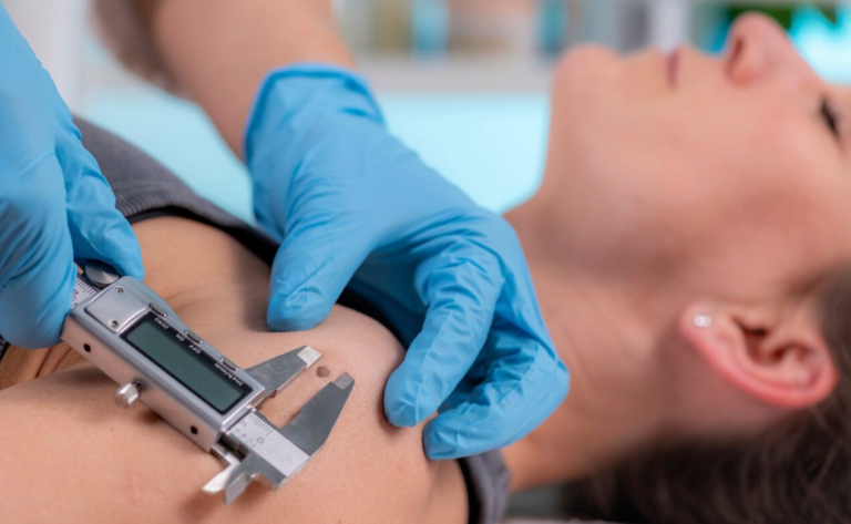 Skin Cancer Diagnosis Delays Caused by Lockdowns Led to 12,000 Years of Life Lost