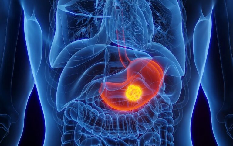 Doctors Warn of Mysterious Cancer ‘Epidemic’