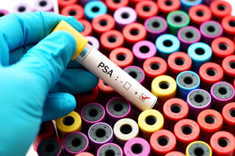 Why Cancer Screening Doesn’t Save Lives
