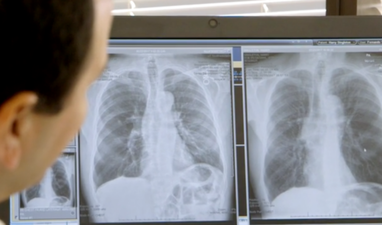Proper Treatment of the Seriously Ill is the Only Covid Intervention That was Ever Needed