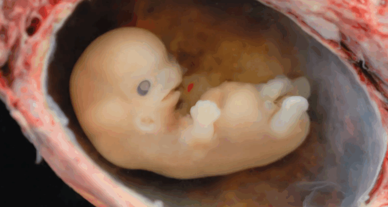 Tearing Bodies Apart on the Altar of Science